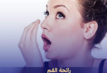 أسباب رائحة الفم الكريهة mouth smell علاج رائحة الفم 2024