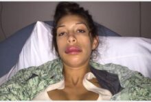 فضائح الفنانات وتعرض عارضة الازياء فرح ابراهام نفخ شفايف بعد عملية التجميل