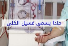 ماذا تسمى عملية غسل الكلى ؟