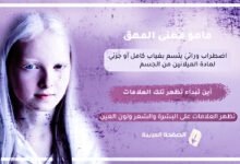 معنى مرض المهق albinism اين تبداء تظهر اعراض المهق