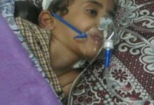 طفلة السرطان : سبب وفاة الطفلة جنى الطفلة جنا