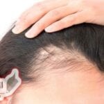 علاج الشعر الخفيف بالأعشاب والزيوت الطبيعية