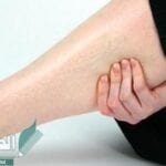 أسباب الشد العضلي وطرق الوقاية